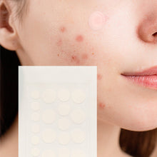 Load image into Gallery viewer, Hydrocolloid Pimple Patch, 120 - Count, Multi Size Acne Solution 5 Pack - Peakly