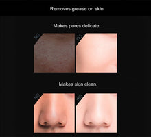 Load image into Gallery viewer, Volcanic Stone Oil - Absorbing Face Roller - Peakly
